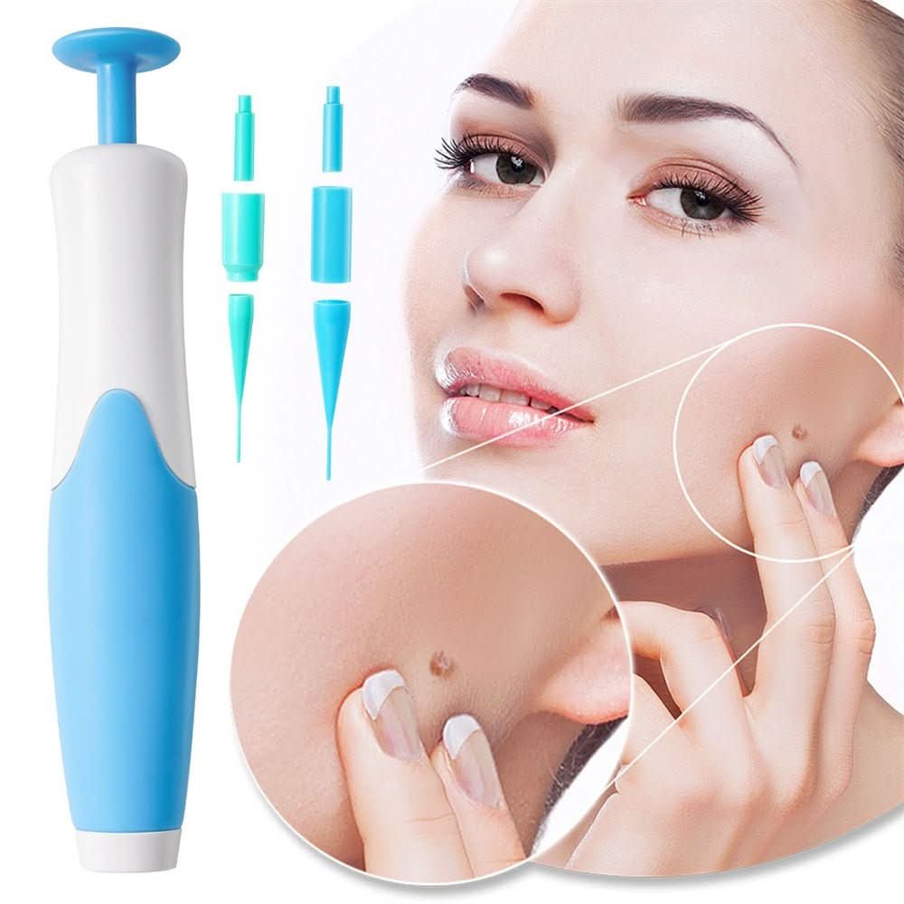 Davy | Skin Tag Remover for Warts and Skin Tags